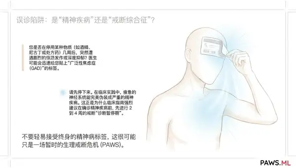 AI 专家会诊：多智能体 AI 如何精准区分“戒断综合征 (PAWS)”与“临床抑郁/焦虑症” | PAWS ML AI System