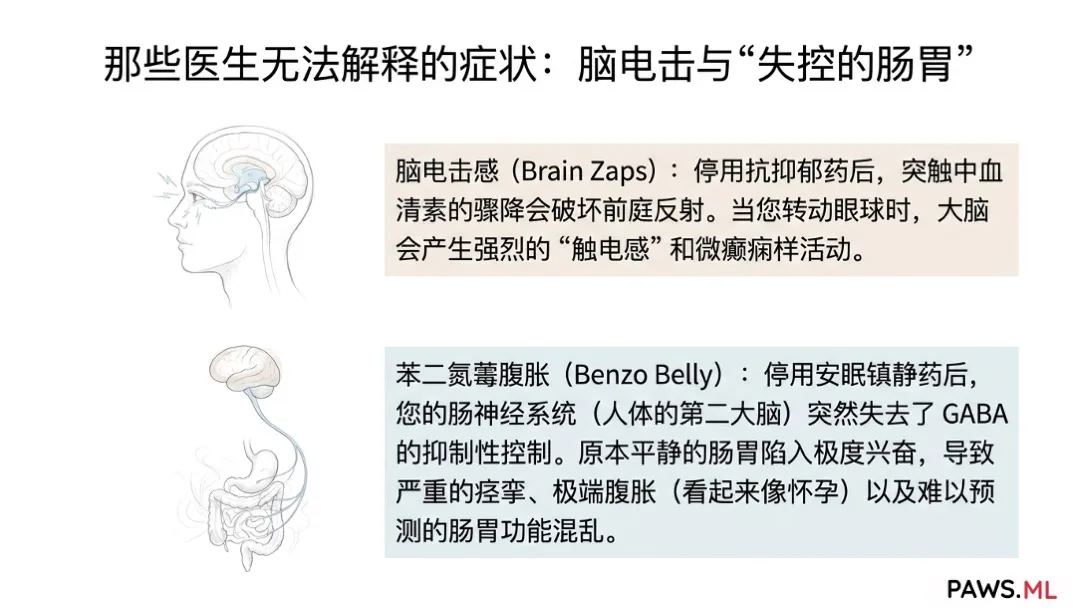 被医生忽视的PAWS戒断症状:脑电击感、苯二氮䓬腹胀与铅样乏力 | PAWS.ML